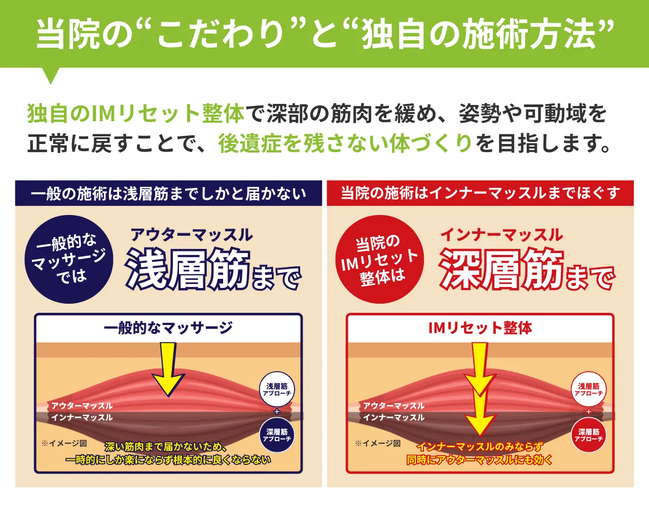 独自のIMリセット整体